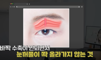 쌍꺼풀하면 대박나는 4가지 유형 사진 19