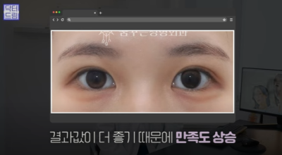 쌍꺼풀하면 대박나는 4가지 유형 사진 23