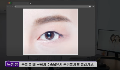 쌍꺼풀하면 대박나는 4가지 유형 사진 16
