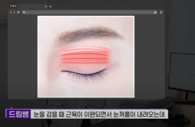 쌍꺼풀하면 대박나는 4가지 유형 사진 17