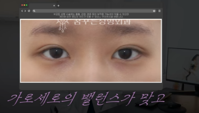 쌍꺼풀하면 대박나는 4가지 유형 사진 28