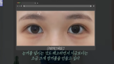 [강남역성형외과] 성형외과 처음갈 때 망하고 싶지 않으면 보세요 (상담꿀팁, 병원선택기준) 사진 25