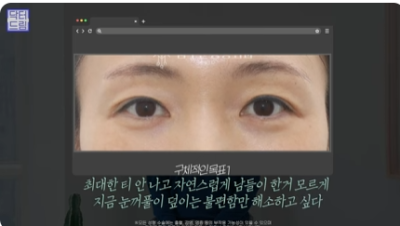 [강남역성형외과] 성형외과 처음갈 때 망하고 싶지 않으면 보세요 (상담꿀팁, 병원선택기준) 사진 23