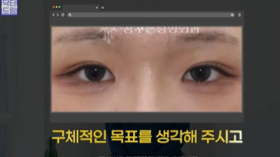 [강남역성형외과] 성형외과 처음갈 때 망하고 싶지 않으면 보세요 (상담꿀팁, 병원선택기준) 사진 27