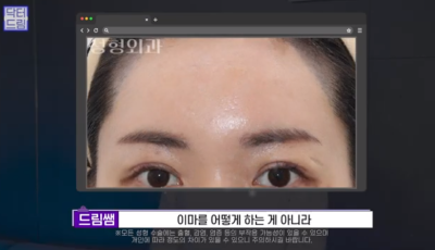 [강남역 성형외과] 깊어져만 가는 이마주름이 고민이라면 이것을 하세요 사진 26