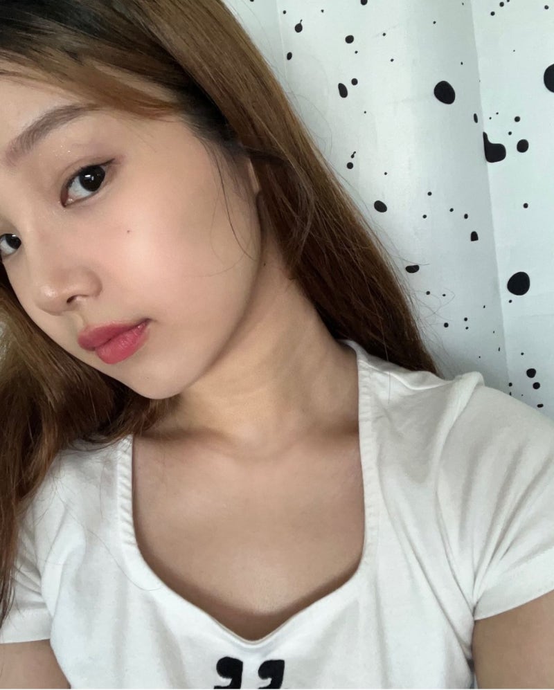 [신논현성형외과] 꿈꾸는 성형외과에서 경험한 쁘띠 성형과 티타늄 레이저 후기: 일본인 관광 시술 후기 사진 9