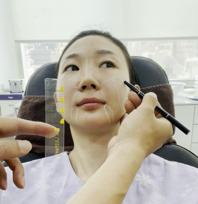 울쎄라 체험기: 피부 리프팅의 새로운 시작 사진 3
