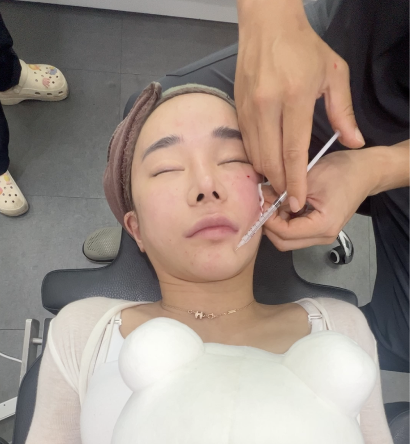 [강남역 성형외과] 여름철 피부 관리와 동안 피부의 비밀 사진 6