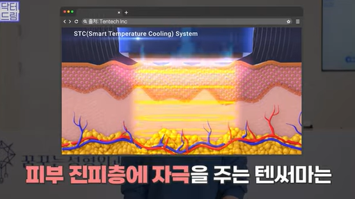 [강남역 성형외과] 닥터드림이 알려주는 내 얼굴에 딱 맞는 레이저 고르기 /레이저 오래가는 법 사진 21