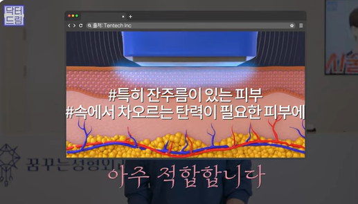 [강남역 성형외과] 닥터드림이 알려주는 내 얼굴에 딱 맞는 레이저 고르기 /레이저 오래가는 법 사진 22