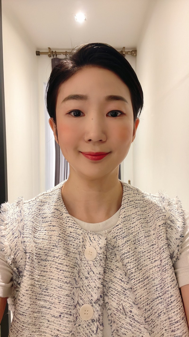 [강남역성형외과] 울쎄라와 티타늄 레이저를 번갈아 받은 후기 사진 7