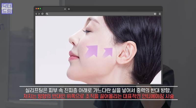 실리프팅 가장 효과 좋은 나이/ 실리프팅 몇살부터 하나요? 사진 6