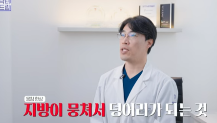 눈밑지방 없애러 왔는데 지방이식을 하라구요? 사진 18