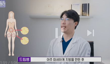 눈밑지방 없애러 왔는데 지방이식을 하라구요? 사진 16