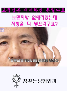 눈밑지방 없애러 왔는데 지방이식을 하라구요? 사진 30