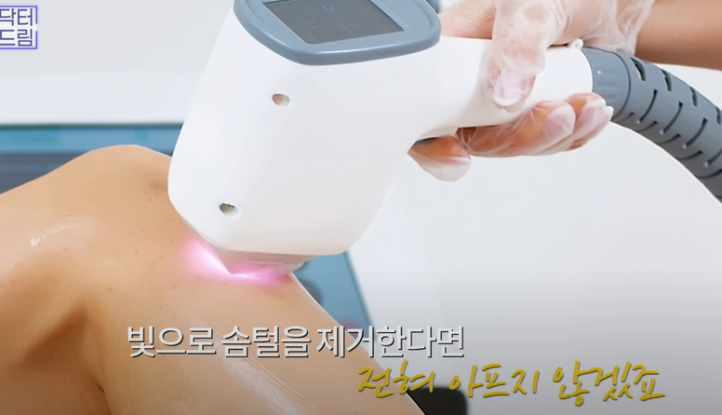 안아프고 하자마자 이뻐지는 티타늄레이저, 나만 아픈 이유? 작용원리 알아보기 사진 11