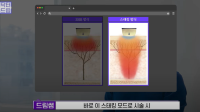 안아프고 하자마자 이뻐지는 티타늄레이저, 나만 아픈 이유? 작용원리 알아보기