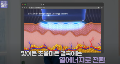 안아프고 하자마자 이뻐지는 티타늄레이저, 나만 아픈 이유? 작용원리 알아보기 사진 23