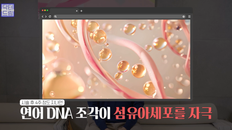 [속건조에 좋은 스킨부스터]리쥬란vs리제반 뭐가 좋은지 알려드려요