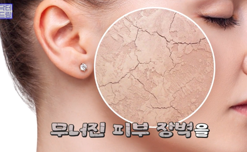 [속건조에 좋은 스킨부스터]리쥬란vs리제반 뭐가 좋은지 알려드려요 사진 10