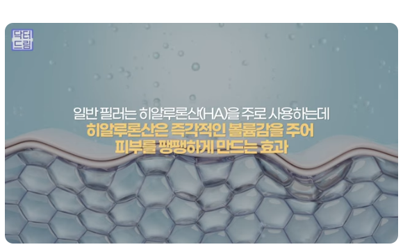 쥬베룩 vs 쥬베룩볼륨 vs 필러 사진 11