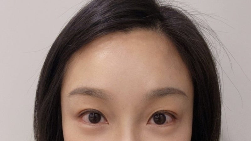 역삼동성형외과 방문을 고민하시는 분께 드리는 편지 -장준철 대표원장 진료철학 사진 12