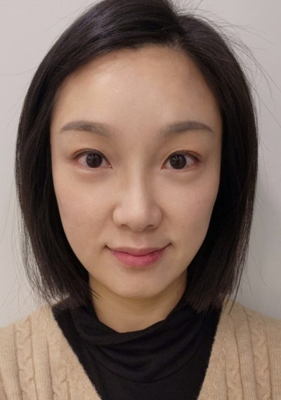 역삼 성형외과, 13년차 전문의가 아내를 직접 수술한 이유 사진 8