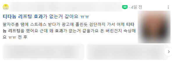 강남역티타늄리프팅? 안 아프게 효과 높이는 방법, 대표원장이 밝힙니다. 사진 2