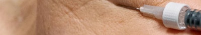 신논현 성형외과 팔자주름 실리프팅? 실패하지 않으려면 이것만 보고 가세요. 사진 27