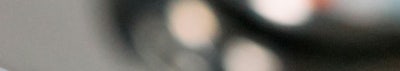 신논현 성형외과 팔자주름 실리프팅? 실패하지 않으려면 이것만 보고 가세요. 사진 14