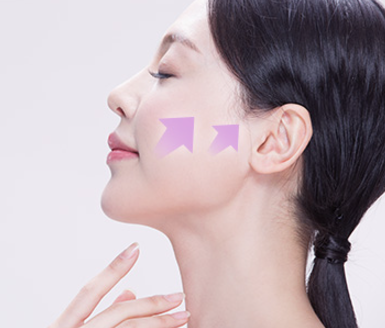 신논현 성형외과 팔자주름 실리프팅? 실패하지 않으려면 이것만 보고 가세요. 사진 4