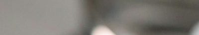 신논현 성형외과 팔자주름 실리프팅? 실패하지 않으려면 이것만 보고 가세요. 사진 10