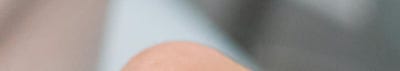 신논현 성형외과 팔자주름 실리프팅? 실패하지 않으려면 이것만 보고 가세요. 사진 19