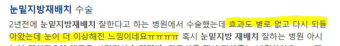 강남 눈밑지방재배치 재발? 유지 기간 궁금하다면 읽어보세요