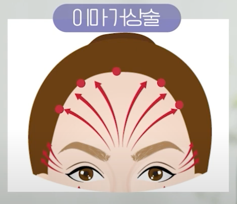 강남 이마거상, 후기 위주로 보고 선택하면 위험한 이유 알려드립니다. 사진 3