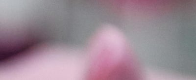 강남안면거상, 먼저 권유드리지 않는 이유? 솔직히 밝힙니다. 사진 22