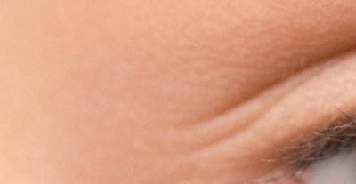 내시경이마거상, 받고 나서 후회하지 않으려면 살펴야 하는 것 사진 19