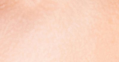 내시경이마거상, 받고 나서 후회하지 않으려면 살펴야 하는 것 사진 27