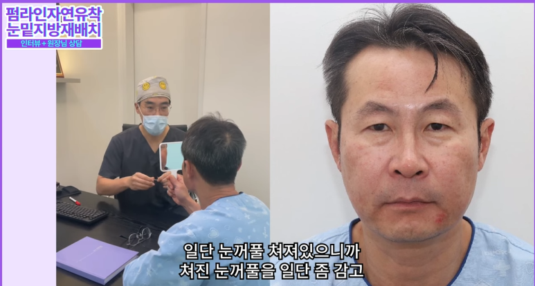 강남 남자눈성형, 자연스럽게 잘하는 병원을 찾고 계신다면