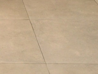 강남 상안검수술, 흉터가 걱정이라면? 사진 24