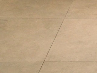 강남 상안검수술, 흉터가 걱정이라면? 사진 22