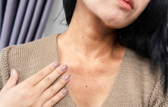 겨울철 탄력 관리 내 피부에는? 티타늄 텐써마 울쎄라 리프팅 차이 사진 19