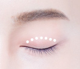 자연스러운 쌍꺼풀을 원한다면? 강남역 자연유착 쌍꺼풀 수술! 사진 3