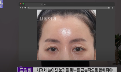 요즘 쌍꺼풀 안하는 상상초월 이유/ 쌍꺼풀 대신 이거합니다 사진 21