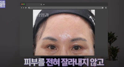 요즘 쌍꺼풀 안하는 상상초월 이유/ 쌍꺼풀 대신 이거합니다 사진 25