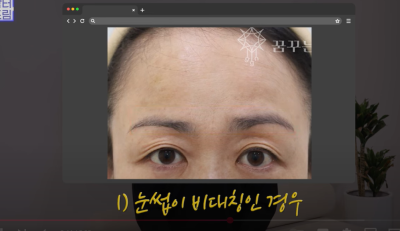 요즘 쌍꺼풀 안하는 상상초월 이유/ 쌍꺼풀 대신 이거합니다 사진 14