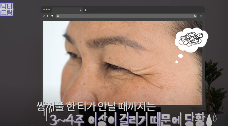 요즘 쌍꺼풀 안하는 상상초월 이유/ 쌍꺼풀 대신 이거합니다 사진 4