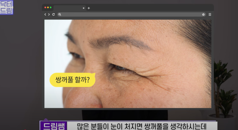 요즘 쌍꺼풀 안하는 상상초월 이유/ 쌍꺼풀 대신 이거합니다 사진 3