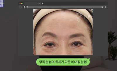 요즘 쌍꺼풀 안하는 상상초월 이유/ 쌍꺼풀 대신 이거합니다 사진 16