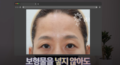 요즘 쌍꺼풀 안하는 상상초월 이유/ 쌍꺼풀 대신 이거합니다 사진 30